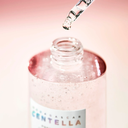 skin1004-ampoule-serum-100ml-poremizing-fresh-ampoule-38609117708534_1440x.jpg.webp